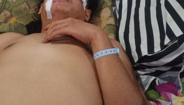 Kuasa Hukum Penganiayaan : Polsek Kikim Timur Harus Segera Tangkap Berli Okivansyah Tersangka Penganiayaan Berat
